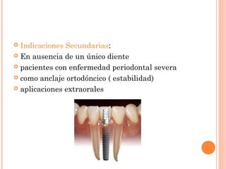  Indicaciones Secundarias:
 En ausencia de un único diente
 pacientes con enfermedad periodontal severa
 como anclaje ortodóncico ( estabilidad)
 aplicaciones extraorales
 