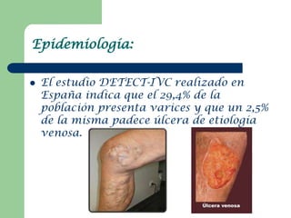 Epidemiología:

   El estudio DETECT-IVC realizado en
    España indica que el 29,4% de la
    población presenta varices...