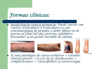 Formas clínicas:
   Insuficiencia venosa primaria: Puede cursar con
    varices (reticulares o tronculares) o con
    sin...