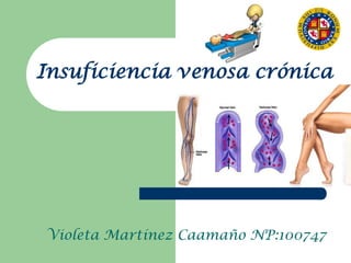 Insuficiencia venosa crónica




Violeta Martínez Caamaño NP:100747
 