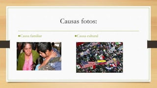 Causas fotos:
●Causa cultural●Causa familiar
 