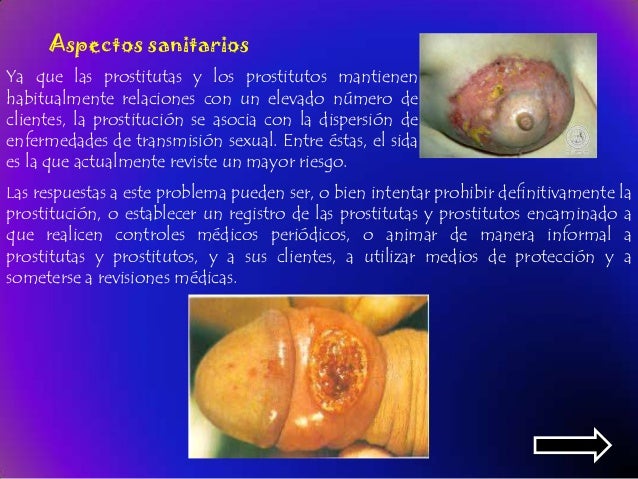 prostitutas en cuba enfermedades prostitutas con preservativo prostitutas en cuba enfermedades prostitutas con preservativo