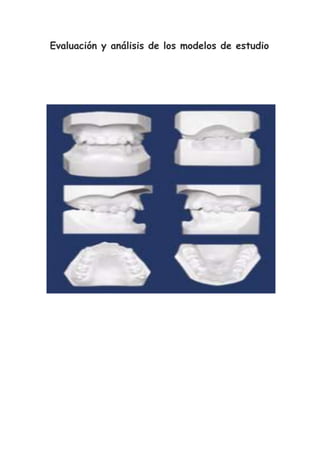 Evaluación y análisis de los modelos de estudio
 