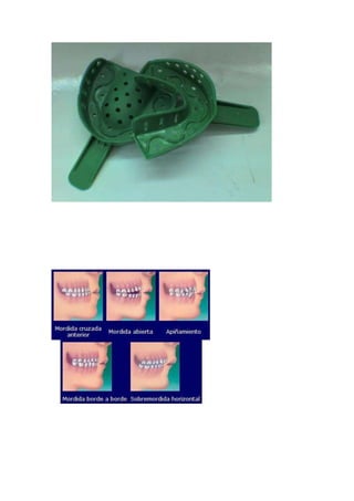 ANALISIS  DE MODELOS DE ESTUDIO