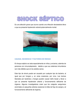 Es una afección grave que ocurre cuando una infección devastadora lleva 
a que se presente hipotensión arterial potencialmente mortal. 
CAUSAS, INCIDENCIA Y FACTORES DE RIESGO 
El choque séptico se ceba especialmente en niños y ancianos, además de 
personas con inmunodepresión, debido a que sus sistemas inmunitarios 
son más débiles que en los adultos sanos. 
Este tipo de shock puede ser causado por cualquier tipo de bacteria, al 
igual que por hongos y, en raras ocasiones, por virus. Las toxinas 
liberadas por bacterias u hongos pueden causar daño tisular y llevar a 
que se presente hipotensión arterial y funcionamiento deficiente de 
órganos. Algunos investigadores creen que los coágulos sanguíneos 
anormales en pequeñas arterias ocasionan la falta de flujo de sangre y el 
funcionamiento deficiente de órganos. 
 