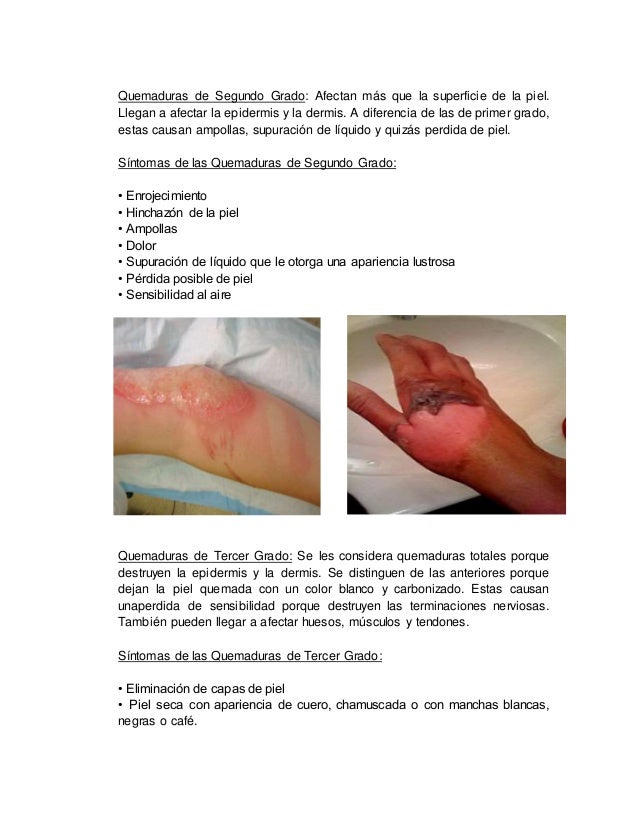 Quemaduras de tercer grado tratamiento pdf file