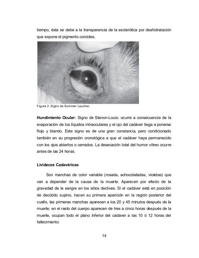 Como arreglar las pecas el limón