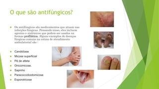 O que são antifúngicos?
 Os antifúngicos são medicamentos que atuam nas
infecções fúngicas. Pensando nisso, eles incluem
agentes e sistêmicos que podem ser usados na
formas profilática. Alguns exemplos de doenças
fúngicas comuns na rotina de atendimento
ambulatorial são :
 Candidíase
 Micose superficial
 Pé de atleta
 Onicomicose.
 Sapinho
 Paracoccidioidomicose
 Esporotricose
 