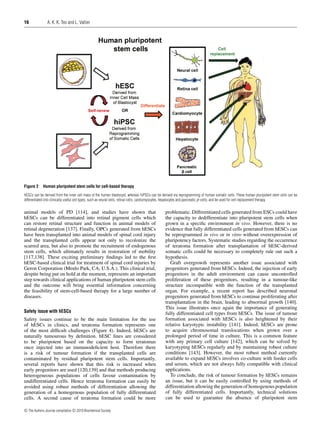 16

Figure 2

A. K. K. Teo and L. Vallier

Human pluripotent stem cells for cell-based therapy

hESCs can be derived from the inner cell mass of the human blastocyst, whereas hiPSCs can be derived via reprogramming of human somatic cells. These human pluripotent stem cells can be
differentiated into clinically useful cell types, such as neural cells, retinal cells, cardiomyocytes, hepatocytes and pancreatic β-cells, and be used for cell replacement therapy.

animal models of PD [114], and studies have shown that
hESCs can be differentiated into retinal pigment cells which
can restore retinal structure and function in animal models of
retinal degeneration [137]. Finally, OPCs generated from hESCs
have been transplanted into animal models of spinal cord injury
and the transplanted cells appear not only to recolonize the
scarred area, but also to promote the recruitment of endogenous
stem cells, which ultimately results in restoration of mobility
[117,138]. These exciting preliminary ﬁndings led to the ﬁrst
hESC-based clinical trial for treatment of spinal cord injuries by
Geron Corporation (Menlo Park, CA, U.S.A.). This clinical trial,
despite being put on hold at the moment, represents an important
step towards clinical applications of human pluripotent stem cells
and the outcome will bring essential information concerning
the feasibility of stem-cell-based therapy for a large number of
diseases.
Safety issue with hESCs

Safety issues continue to be the main limitation for the use
of hESCs in clinics, and teratoma formation represents one
of the most difﬁcult challenges (Figure 4). Indeed, hESCs are
naturally tumourous by deﬁnition. hESC lines are considered
to be pluripotent based on the capacity to form teratomas
once injected into an immunodeﬁcient host. Therefore there
is a risk of tumour formation if the transplanted cells are
contaminated by residual pluripotent stem cells. Importantly,
several reports have shown that this risk is increased when
early progenitors are used [120,139] and that methods producing
heterogeneous populations of cells favour contamination by
undifferentiated cells. Hence teratoma formation can easily be
avoided using robust methods of differentiation allowing the
generation of a homogenous population of fully differentiated
cells. A second cause of teratoma formation could be more
c The Authors Journal compilation c 2010 Biochemical Society

problematic. Differentiated cells generated from ESCs could have
the capacity to dedifferentiate into pluripotent stem cells when
grown in a speciﬁc environment in vivo. However, there is no
evidence that fully differentiated cells generated from hESCs can
be reprogrammed in vivo or in vitro without overexpression of
pluripotency factors. Systematic studies regarding the occurrence
of teratoma formation after transplantation of hESC-derived
somatic cells could be necessary to completely rule out such a
hypothesis.
Graft overgrowth represents another issue associated with
progenitors generated from hESCs. Indeed, the injection of early
progenitors in the adult environment can cause uncontrolled
proliferation of these progenitors, resulting in a tumour-like
structure incompatible with the function of the transplanted
organ. For example, a recent report has described neuronal
progenitors generated from hESCs to continue proliferating after
transplantation in the brain, leading to abnormal growth [140].
This issue illustrates once again the importance of generating
fully differentiated cell types from hESCs. The issue of tumour
formation associated with hESCs is also heightened by their
relative karyotypic instability [141]. Indeed, hESCs are prone
to acquire chromosomal translocations when grown over a
prolonged period of time in culture. This is a common feature
with any primary cell culture [142], which can be solved by
karyotyping hESCs regularly and by maintaining robust culture
conditions [143]. However, the most robust method currently
available to expand hESCs involves co-culture with feeder cells
and serum, which are not always fully compatible with clinical
applications.
To conclude, the risk of tumour formation by hESCs remains
an issue, but it can be easily controlled by using methods of
differentiation allowing the generation of homogenous population
of fully differentiated cells. Importantly, technical solutions
can be used to guarantee the absence of pluripotent stem

 