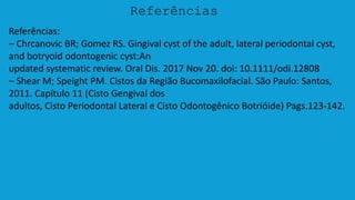 Referências
Referências:
– Chrcanovic BR; Gomez RS. Gingival cyst of the adult, lateral periodontal cyst,
and botryoid odontogenic cyst:An
updated systematic review. Oral Dis. 2017 Nov 20. doi: 10.1111/odi.12808
– Shear M; Speight PM. Cistos da Região Bucomaxilofacial. São Paulo: Santos,
2011. Capítulo 11 (Cisto Gengival dos
adultos, Cisto Periodontal Lateral e Cisto Odontogênico Botrióide) Pags.123-142.
 