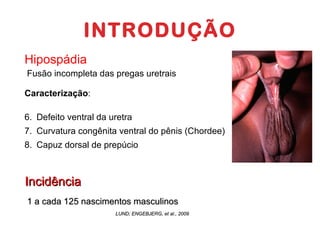 INTRODUÇÃO Hipospádia Fusão incompleta das pregas uretrais  Caracterização :  Defeito ventral da uretra Curvatura congênita ventral do pênis (Chordee)  Capuz dorsal de prepúcio Incidência 1 a cada 125 nascimentos masculinos  LUND; ENGEBJERG, et al., 2009 