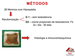 MÉTODOS 26 Meninos com Hipospádia G 1  – sem testosterona G2  – creme propionato de testosterona 1% 2x / dia - 30 dias Histologia e Immunohistoquímica Randomização 