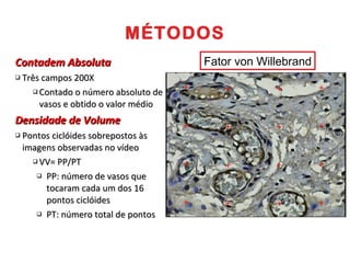 MÉTODOS Contadem Absoluta Três campos 200X Contado o número absoluto de vasos e obtido o valor médio  Densidade de Volume Pontos ciclóides sobrepostos às imagens observadas no vídeo  VV= PP/PT PP: número de vasos que tocaram cada um dos 16 pontos ciclóides PT: número total de pontos  Fator von Willebrand 