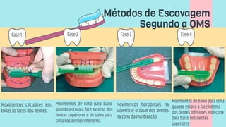 Movimentos circulares em
todas as faces dos dentes.
Fase 1
Métodos de Escovagem
Segundo a OMS
Fase 2 Fase 3 Fase 4
Movimentos de cima para baixo
quando escova a face externa dos
dentes superiores e de baixo para
cima nos dentes inferiores.
Movimentos horizontais na
superfície oclusal dos dentes
na zona da mastigação
Movimentos de baixo para cima
quando escova a face interna
dos dentes inferiores e de cima
para baixo nos dentes
superiores.
 