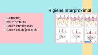 Higiene Interproximal
Fio dentário;
Palitos dentários;
Escovas interproximais;
Escovas unitufo (monotufo).
 
