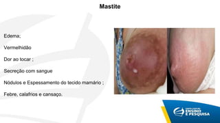 Mastite
Edema;
Vermelhidão
Dor ao tocar ;
Secreção com sangue
Nódulos e Espessamento do tecido mamário ;
Febre, calafrios e cansaço.
 