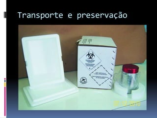 Transporte e preservação
 