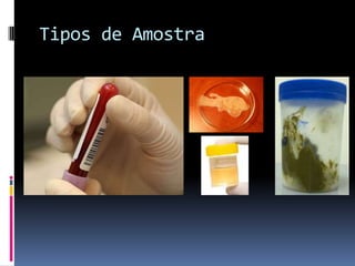 Tipos de Amostra
 
