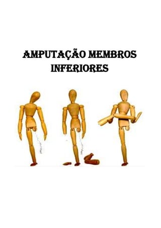 Amputação Membros
Inferiores
 