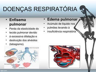 DOENÇAS RESPIRATÓRIA 
• Enfisema 
pulmonar 
• Perda da elasticidade do 
• tecido pulmonar devido 
• à excessiva dilatação e 
• destruição dos alvéolos 
• (tabagismo). 
• Edema pulmonar 
• Acúmulo de líquido nos 
• pulmões levando à 
• insuficiência respiratória 
 