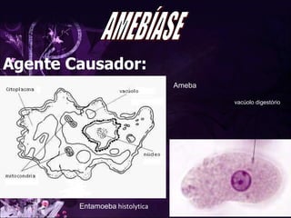 Entamoeba  histolytica Ameba vacúolo digestório AMEBÍASE Agente Causador: 