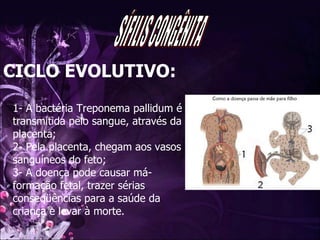 CICLO EVOLUTIVO: 1- A bactéria Treponema pallidum é transmitida pelo sangue, através da placenta; 2- Pela placenta, chegam aos vasos sanguíneos do feto; 3- A doença pode causar má-formação fetal, trazer sérias conseqüências para a saúde da criança e levar à morte. SÍFILIS CONGÊNITA 