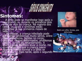 Sintomas:   -  A sífilis pode se manifestar logo após o nascimento ou durante os primeiros dois anos de vida da criança. Na maioria dos casos, os sinais e sintomas estão presentes já nos primeiros meses de vida.   -  Ao nascer, a criança infectada pode apresentar problemas muito sérios, entre eles: pneumonia, feridas no corpo, cegueira, dentes deformados, problemas ósseos, surdez ou retardamento. A doença pode também levar à morte. Há ocorrências em que a criança nasce aparentemente normal e a sífilis se manifesta só mais tarde, após o segundo ano de vida.  Bebê com sífilis: feridas, pele deformada SÍFILIS CONGÊNITA 