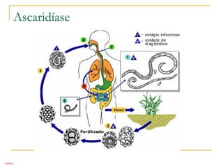 Ascaridíase
Cebola
 