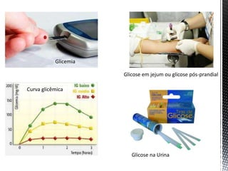 Glicemia
Glicose em jejum ou glicose pós-prandial
Curva glicêmica
Glicose na Urina
 