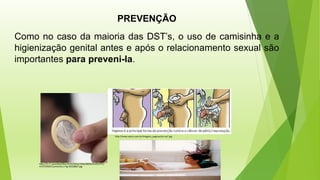 PREVENÇÃO
Como no caso da maioria das DST’s, o uso de camisinha e a
higienização genital antes e após o relacionamento sexual são
importantes para preveni-la.
http://i1.r7.com/data/files/2C92/94A3/29A6/B8D9/0129/A7FC/
4C47/0ADF/Camisinha-2-hg-20100607.jpg
http://www.zanco.com.br/Imagens_paginas/art-sa7.jpg
 