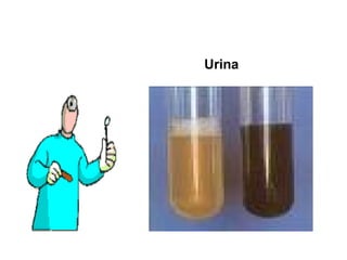 Urina  