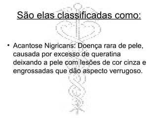 São elas classificadas como: Acantose Nigricans: Doença rara de pele, causada por excesso de queratina deixando a pele com lesões de cor cinza e engrossadas que dão aspecto verrugoso. 