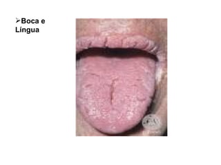 Boca e  Língua 
