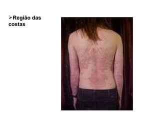 Região das  costas 