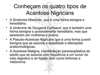 Conheçam os quatro tipos de Acantose Nigricans A Síndrome Miescher, que é uma forma benigna e hereditária; A síndrome de Gougerot Carteaud, que é também uma forma benigna e possivelmente hereditária, mas que aparecem em mulheres e jovens; A Pseudo-Acantose Nigricans que é uma forma juvenil benigna que se associa a obesidade e alterações endocrinológicas; A Acantose Maligna, manifestação paraneoplástica do adulto que se associa com freqüência a um tumor do tubo digestivo e do fígado bem como linfomas e melanoma.  
