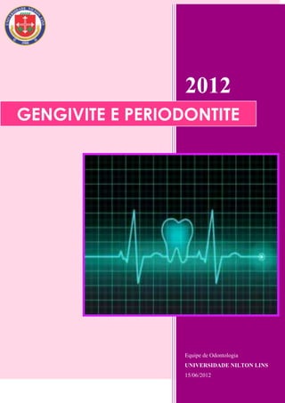 2012
GENGIVITE E PERIODONTITE




                  Equipe de Odontologia
                  UNIVERSIDADE NILTON LINS
                  15/06/2012
 