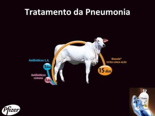 Tratamento da Pneumonia
 