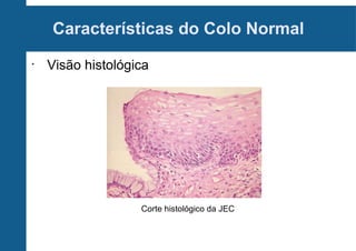 Características do Colo Normal
•
Visão histológica
Corte histológico da JEC
 