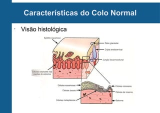 Características do Colo Normal
•
Visão histológica
 