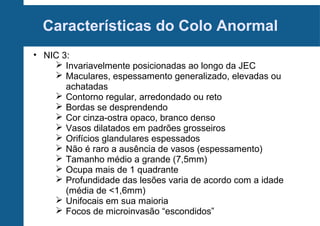 Características do Colo Anormal
• NIC 3:
 Invariavelmente posicionadas ao longo da JEC
 Maculares, espessamento generalizado, elevadas ou
achatadas
 Contorno regular, arredondado ou reto
 Bordas se desprendendo
 Cor cinza-ostra opaco, branco denso
 Vasos dilatados em padrões grosseiros
 Orifícios glandulares espessados
 Não é raro a ausência de vasos (espessamento)
 Tamanho médio a grande (7,5mm)
 Ocupa mais de 1 quadrante
 Profundidade das lesões varia de acordo com a idade
(média de <1,6mm)
 Unifocais em sua maioria
 Focos de microinvasão “escondidos”
 