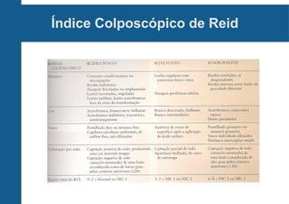 Índice Colposcópico de Reid
 