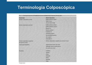 Terminologia Colposcópica
 