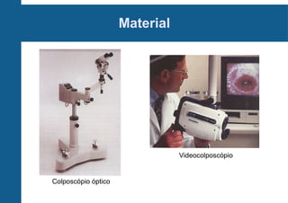 Material
Colposcópio óptico
Videocolposcópio
 