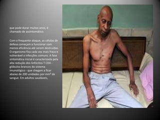 que pode durar muitos anos, é
chamado de assintomático.

Com o frequente ataque, as células de
defesa começam a funcionar com
menos eficiência até serem destruídas.
O organismo fica cada vez mais fraco e
vulnerável a infecções comuns. A fase
sintomática inicial é caracterizada pela
alta redução dos linfócitos T CD4 -
glóbulos brancos do sistema
imunológico - que chegam a ficar
abaixo de 200 unidades por mm³ de
sangue. Em adultos saudáveis,
 