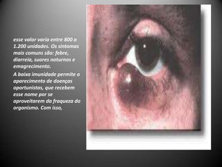 esse valor varia entre 800 a
1.200 unidades. Os sintomas
mais comuns são: febre,
diarreia, suores noturnos e
emagrecimento.
A baixa imunidade permite o
aparecimento de doenças
oportunistas, que recebem
esse nome por se
aproveitarem da fraqueza do
organismo. Com isso,
 