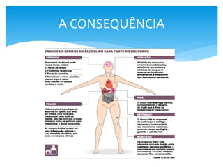 A CONSEQUÊNCIA
 
