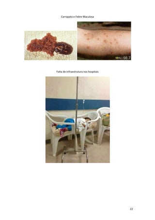 Carrapato e Febre Maculosa

Falta de infraestrutura nos hospitais

22

 