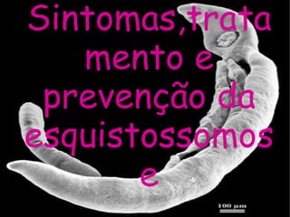 Sintomas,tratamento e prevenção da esquistossomose 