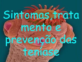 Sintomas,tratamento e prevenção das teníase 