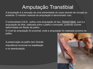Amputação Transtibial
A amputação é a remoção de uma extremidade do corpo através de cirurgia ou
acidente. O membro residual de amputação é denominado coto.
O entrevistado A.M.S., sofreu uma amputação do tipo TRANSTIBIAl que é a
amputação da tíbia, realizada entre o joelho e tornozelo, podendo ocorrer
deformidade em flexão de joelho.
O nível de amputação foi proximal, onde a amputação foi realizada próximo do
joelho.
A preservação do joelho tem Grande
importância funcional na reabilitação
e na deambulação.
 
